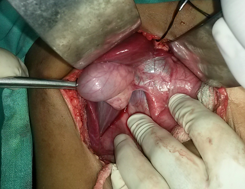 Pediatric G.I. Surgery Image 4